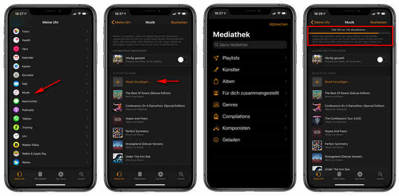 Amazon Musik auf Apple Watch übertragen